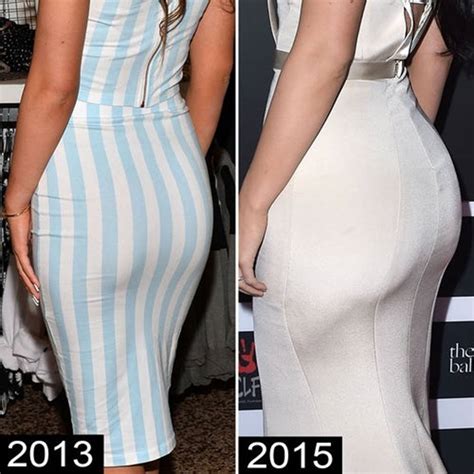 Kylie Jenner Before and After Plastic Surgery Photos Reveal Drastic ...