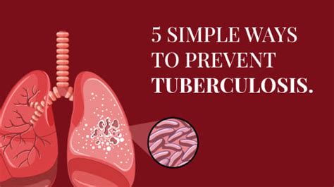 Tuberculosis (TB): Symptoms, Types, Diagnosis, and More - Rela Hospital