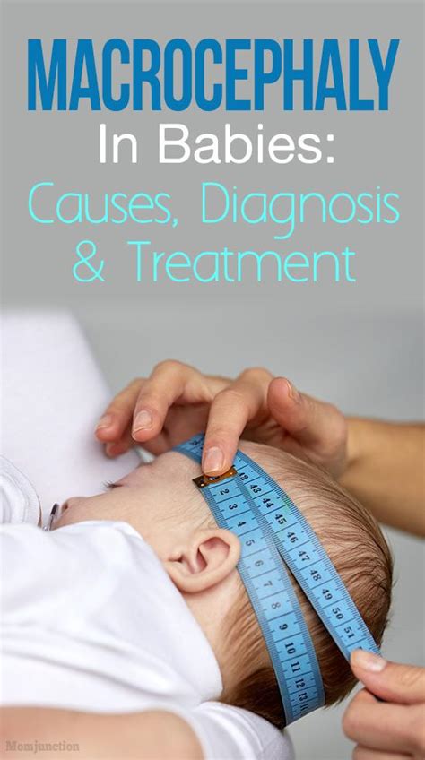 Macrocephaly In Babies: Causes, Diagnosis And Treatment