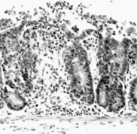 Cecum, rabbit 15598B. The superficial epithelium contains an area of... | Download Scientific ...