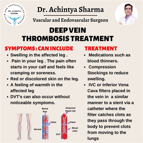 Things you want to know about Deep Vein Thrombosis Treatment