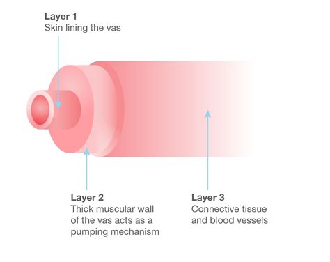 Our unique Vasectomy Reversal Procedure - Tees Urology