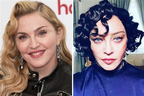 Madonna Before and After Plastic Surgery: Face, Boobs, Buttocks