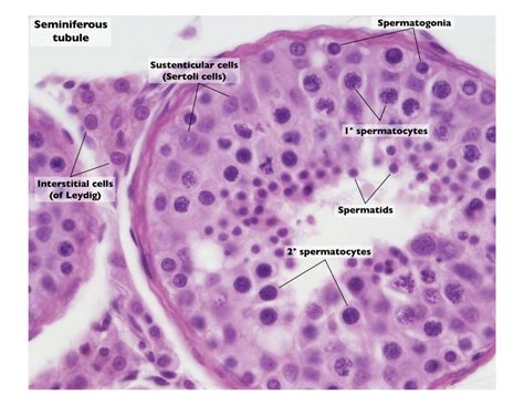 Describe the histology of human testis. Write a note on human sperm.