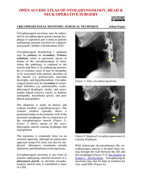 Cricopharyngeal Myotomy Surgical Technique | PDF | Common Carotid ...