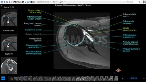 Shoulder MR Arthrogram | e-Anatomy