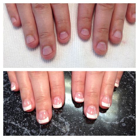 Before and after on a nail biter | Nails, Gel nails, Rings for men