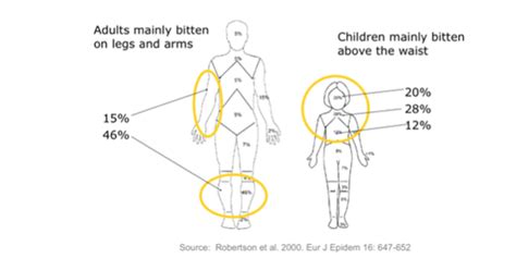 Tick removal tools - Lyme Disease UK