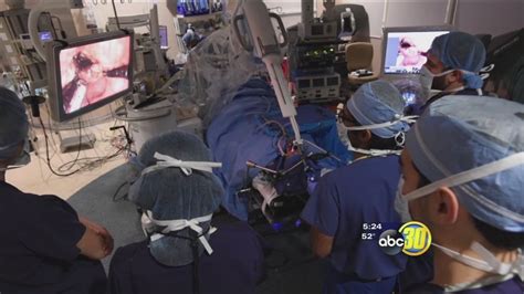 Robotic Snake Treats Head and Neck Tumors - ABC30 Fresno