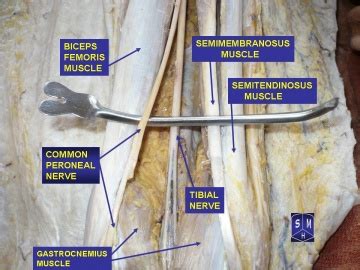 Deep Peroneal Nerve Cadaver