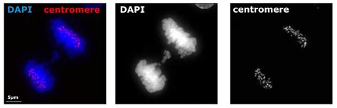 Anti-Centromere Protein Antibody