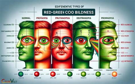 Facts About Red Green Color Blindness: Deficiency!