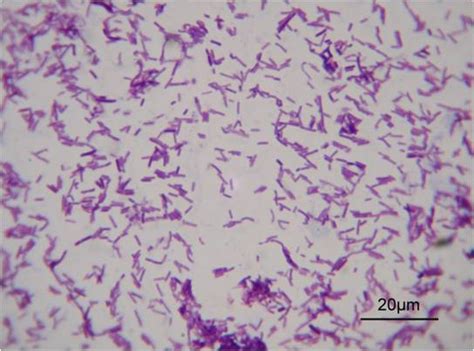 Lactobacillus Casei Gram Stain