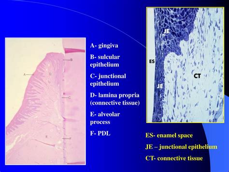 PPT - Junctional Epithelium / Epithelial Attachment PowerPoint ...