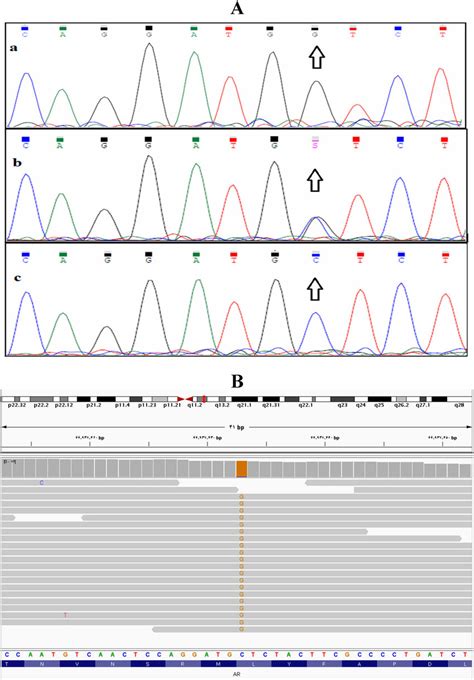 (A) The electropherogram sequencing identified c.2287C > G variant... | Download Scientific Diagram