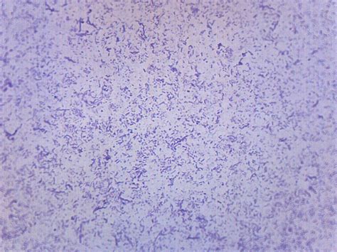 Typical Bacteria, Whole Mount - Prepared Microscope Slide