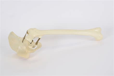 Hemi Pelvis femur left - SYNBONE