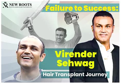 Bald to Bold: Virender Sehwag Hair Transplant Success Story