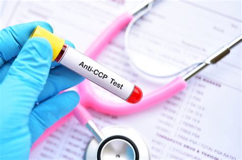 Anti-CCP Antibody Test: Results and What They Mean - SelfHacked