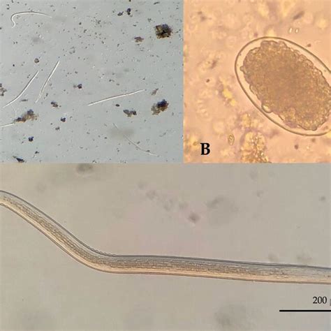 Photomicrographs of hookworms’ larvae and egg, (A) cultured larvae from ...