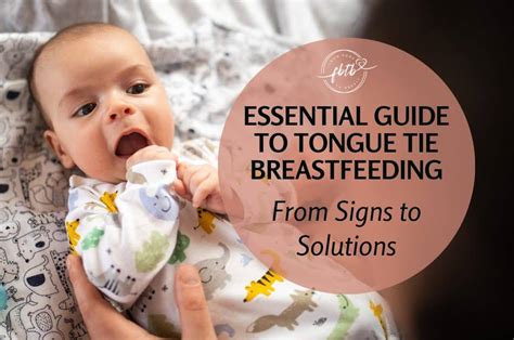 Essential Guide to Tongue Tie Breastfeeding