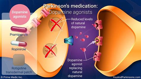 Parkinson s disease symptoms causes treatment – Artofit