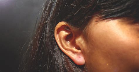 Psoriasis in the Ears: Identification, Treatment, and More