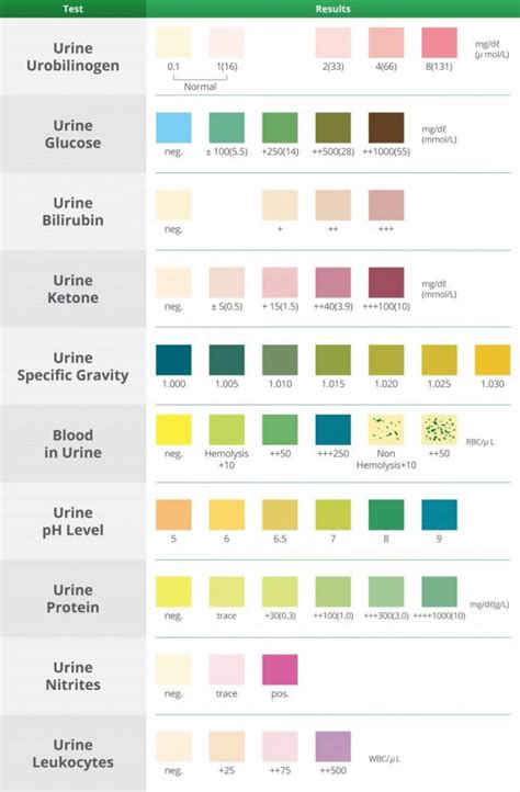 urine color chart urine in test tubes medical vector image - 6 reasons why you should hydrate ...