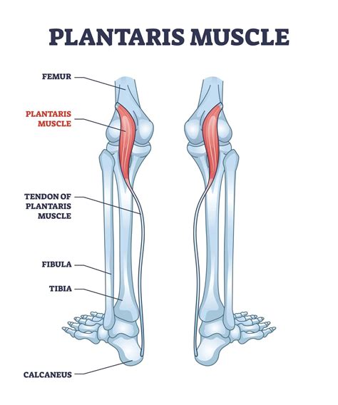 Plantaris Muscle: Learn the Symptoms, Causes & Treatment