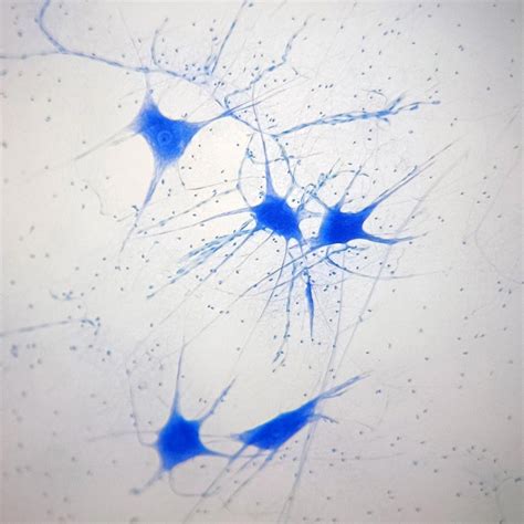 Motor nerve cells, smear from spinal cord of cow showing w.m. of motor nerve cells and their ...