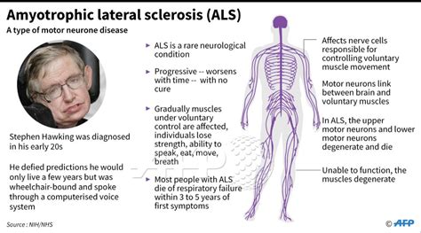 Als: the disease that stephen hawking defied for decades factfile on amyotrophic lateral ...