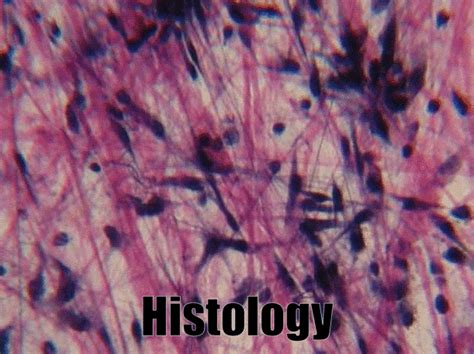 Median Palatal Cyst Histology