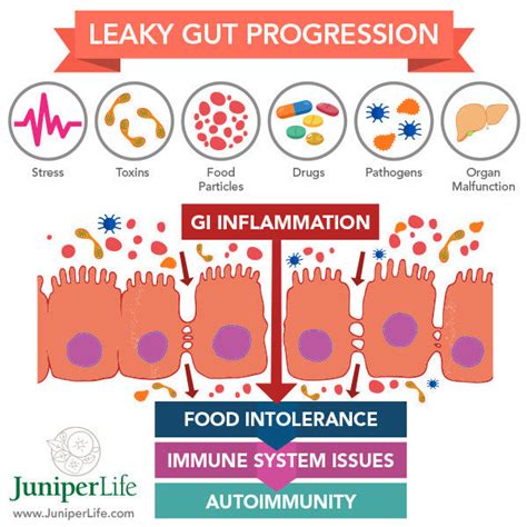 Leaky Gut Syndrome – Its More Common Than You Think – Mike Butler Fitness