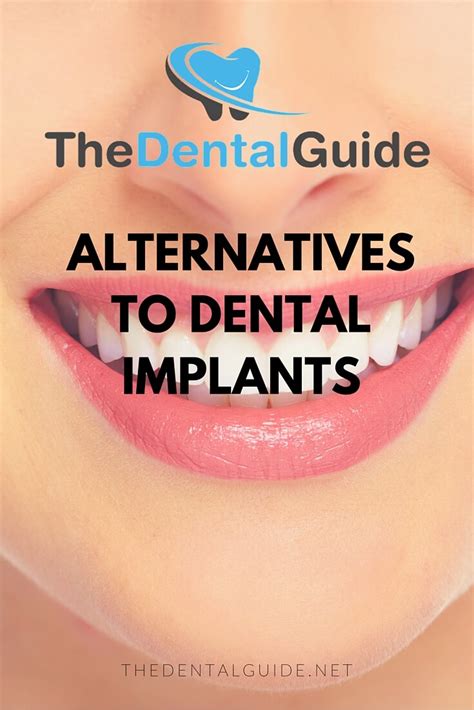 Alternatives to Dental Implants - The Dental Guide