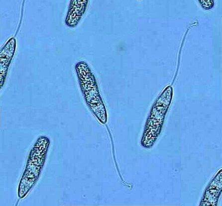 Flagellated protozoa