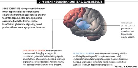 Schizophrenia.com - Schizophrenia Pictures and Images