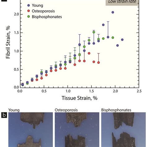 Structure of human cortical bone.: Human bone comes in the form of ...