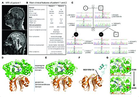 | Patients and novel mutations in the ASNS gene. (A) Sagittal MRI... | Download Scientific Diagram