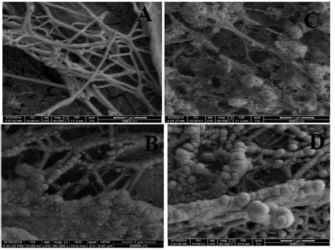 SEM images of bacterial cellulose from Acetobacter xylinum ATCC 10245... | Download Scientific ...