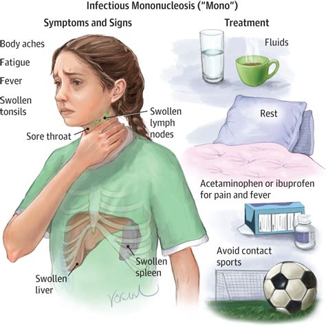 Symptoms Of Mono In Children | CBC Parents