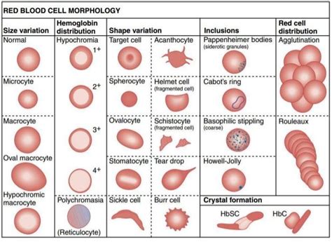 Common Erythrocyte abnormality (with Images) – AcrossPG | Medical ...