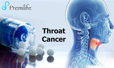 Throat Cancer | Premilife - Homeopathic Remedies