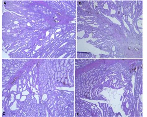 (A, B, C, D) histological examination of the polyp showed branching ...