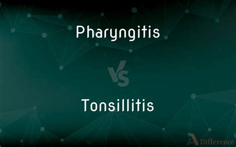 Pharyngitis vs. Tonsillitis — What’s the Difference?