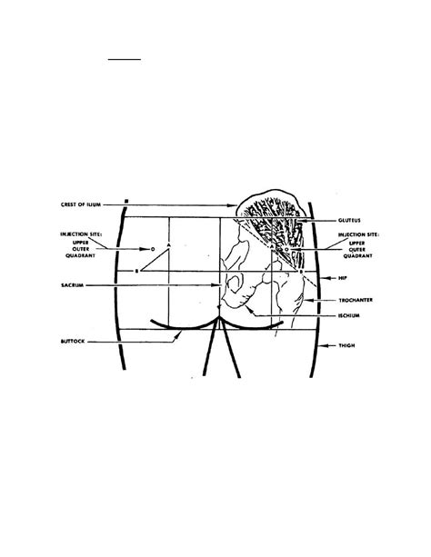 The gallery for --> Intramuscular Injection Diagram