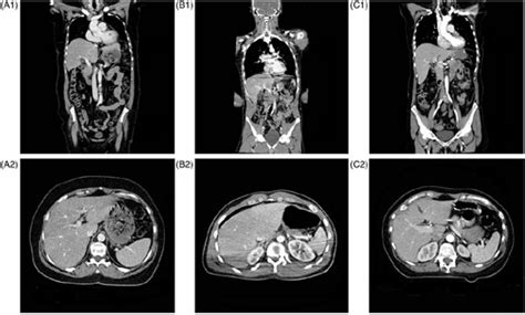 [PDF] Split bolus technique in polytrauma: a prospective study on scan ...