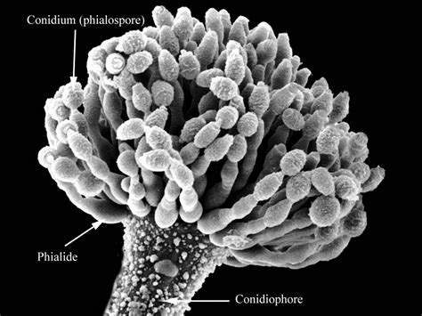 Aspergillus flavus - scanning electron micrograph, rough conidiophore