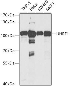 UHRF1 Antibody (PA5-37440)