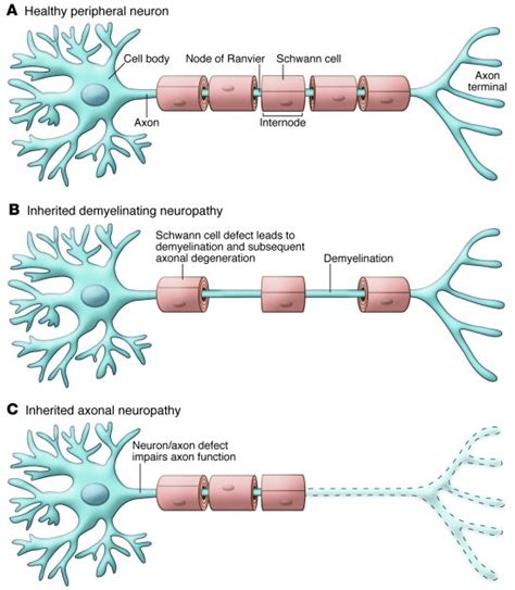 Thin myelin sheaths are sufficient to help restore nervous system impairments in diseases like ...