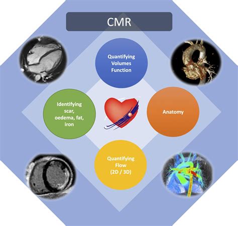 United Kingdom standards for non-invasive cardiac imaging ...